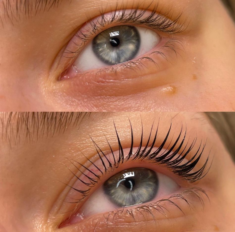 lash lifting 